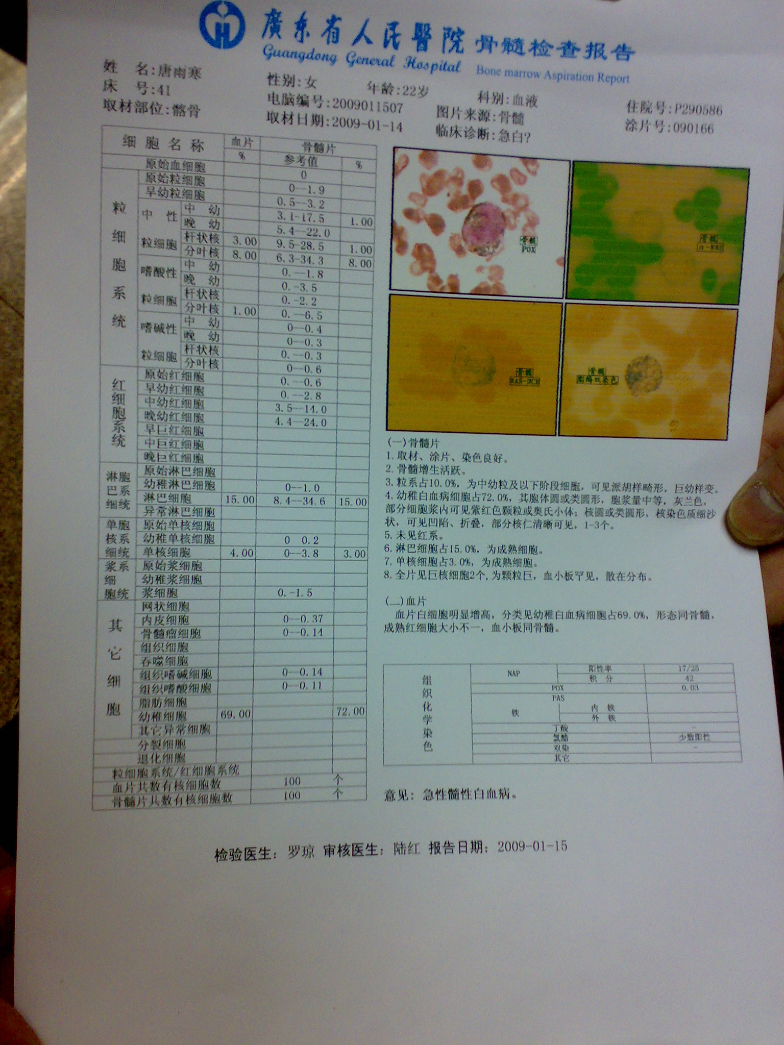 骨髓检查报告